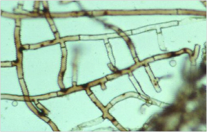 Close-up of fungal hyphae; showing cell walls